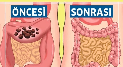 Bağırsakları Tertemiz Yapmanın Yedi Yolu