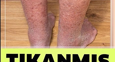 Damarlarınızı Tertemiz Yapacak Sır