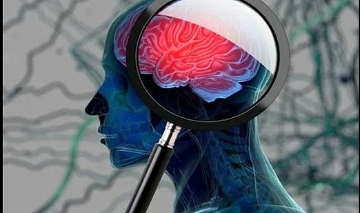 Alzheimer hastalığının ilk belirtisi