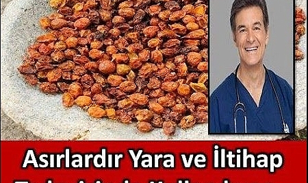 Asırlardır yara ve iltihap tedavisinde kullanılıyor